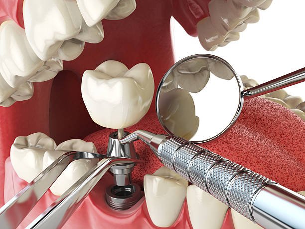 Best Emergency Root Canal Treatment in Meadowood, PA